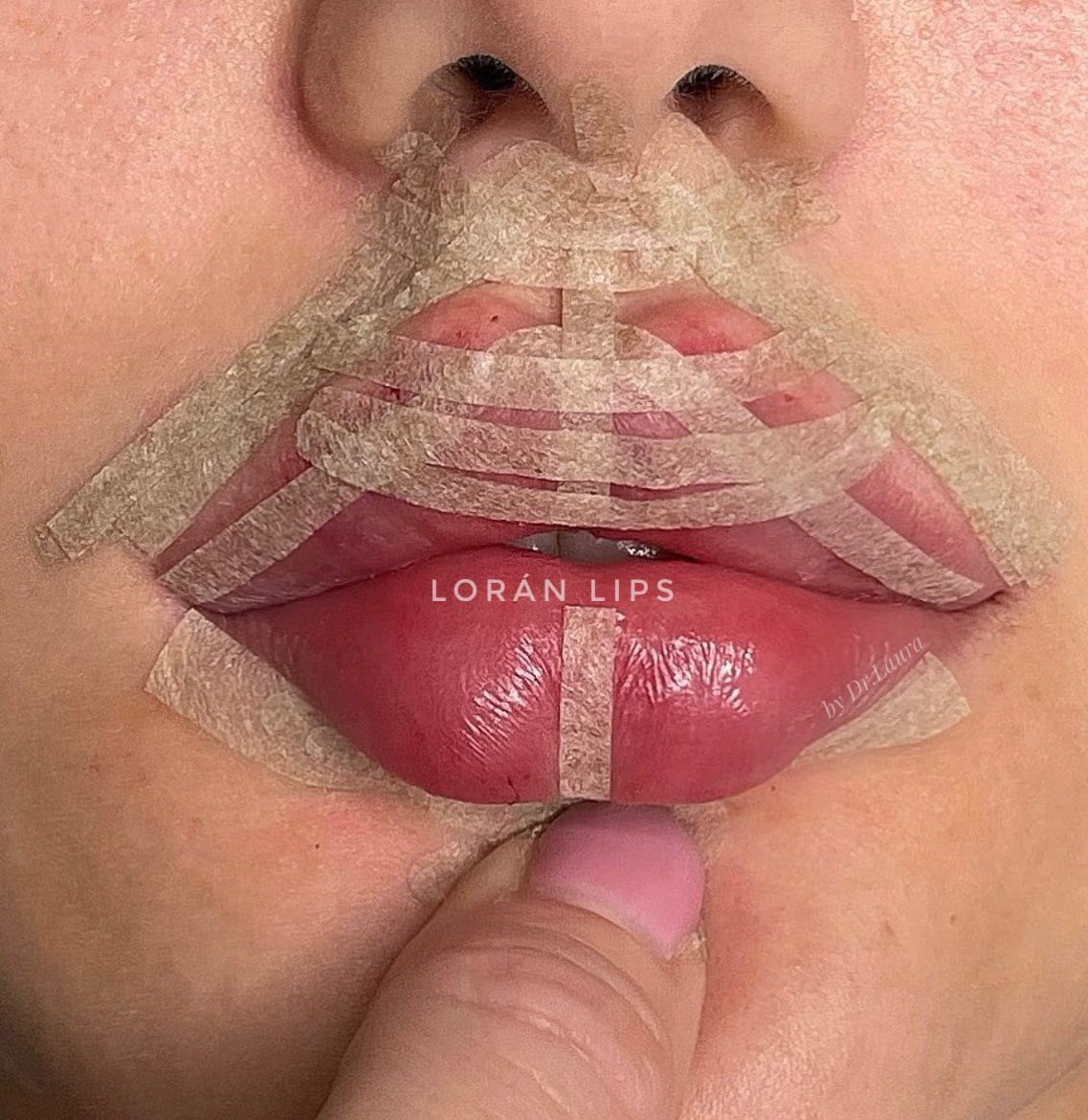 stripp lips bucuresti