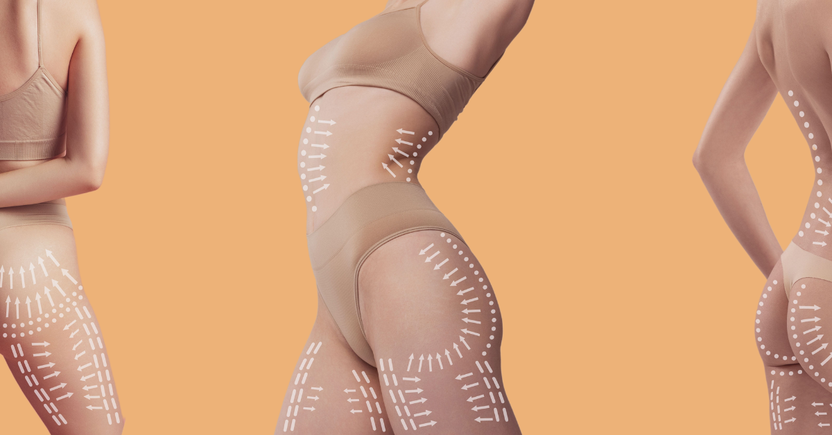 transplat grasime, lipofilling