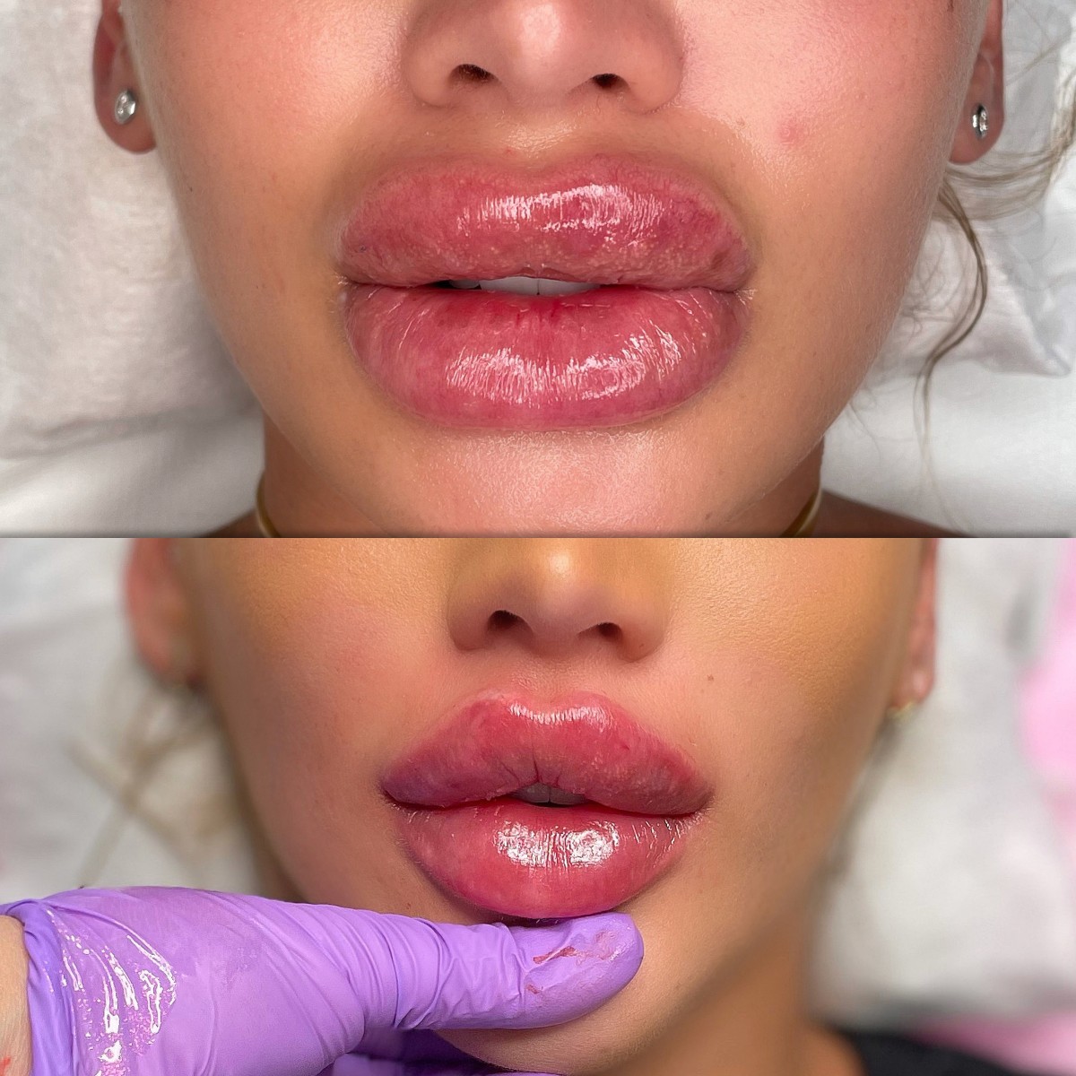 stripp lips Bucuresti