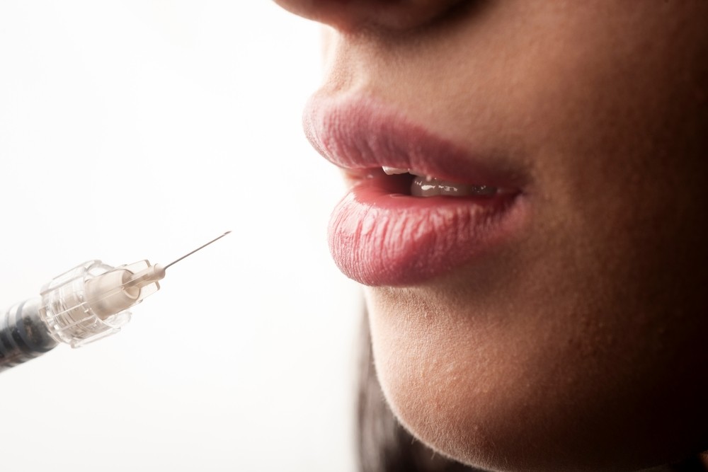 mărire buze București