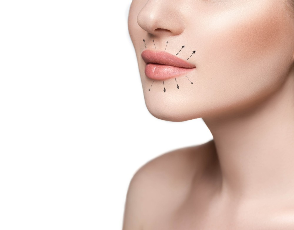 mărire buze București