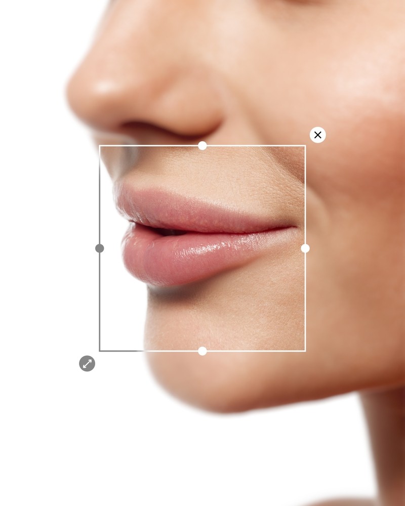 mărire buze București