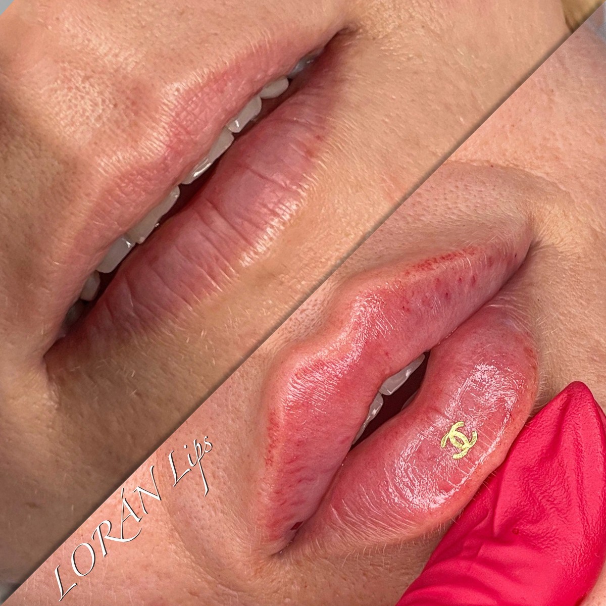 stripp lips București