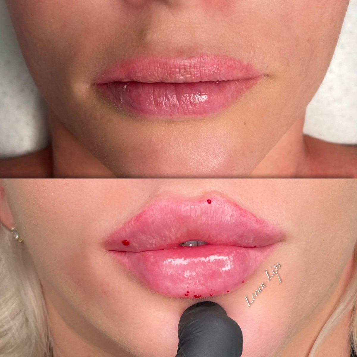 stripp lips București
